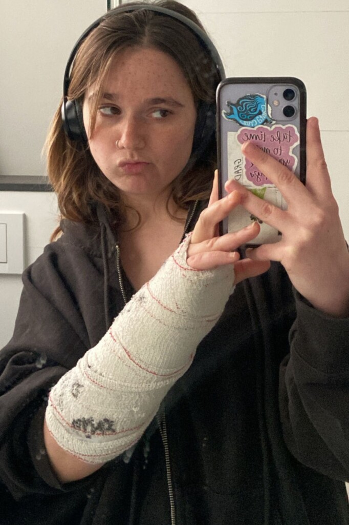 Lila Franco in hospital with broken wrist abroad