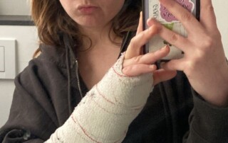 Lila Franco (UCSC) with broken wrist in Barcelona