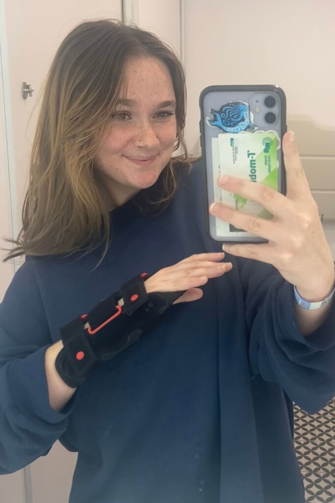 Lila Franco (UCSC) learning to navigate a double wrist fracture while in Barcelona