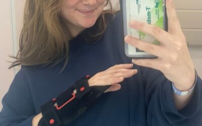 How a Broken Wrist in Barcelona Taught Me Resilience