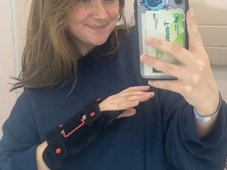 How a Broken Wrist in Barcelona Taught Me Resilience