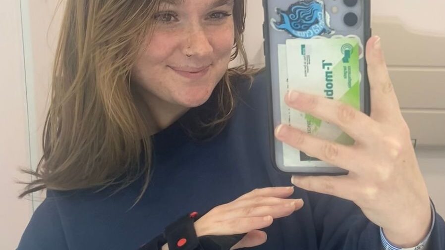 Lila Franco with a broken wrist taking a selfie